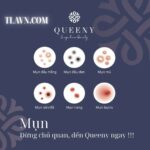 Combo 5 Buổi Chăm Sóc Da Mụn Chuyên Sâu Tại Hệ Thống Queeny Beauty Center - Ảnh 3