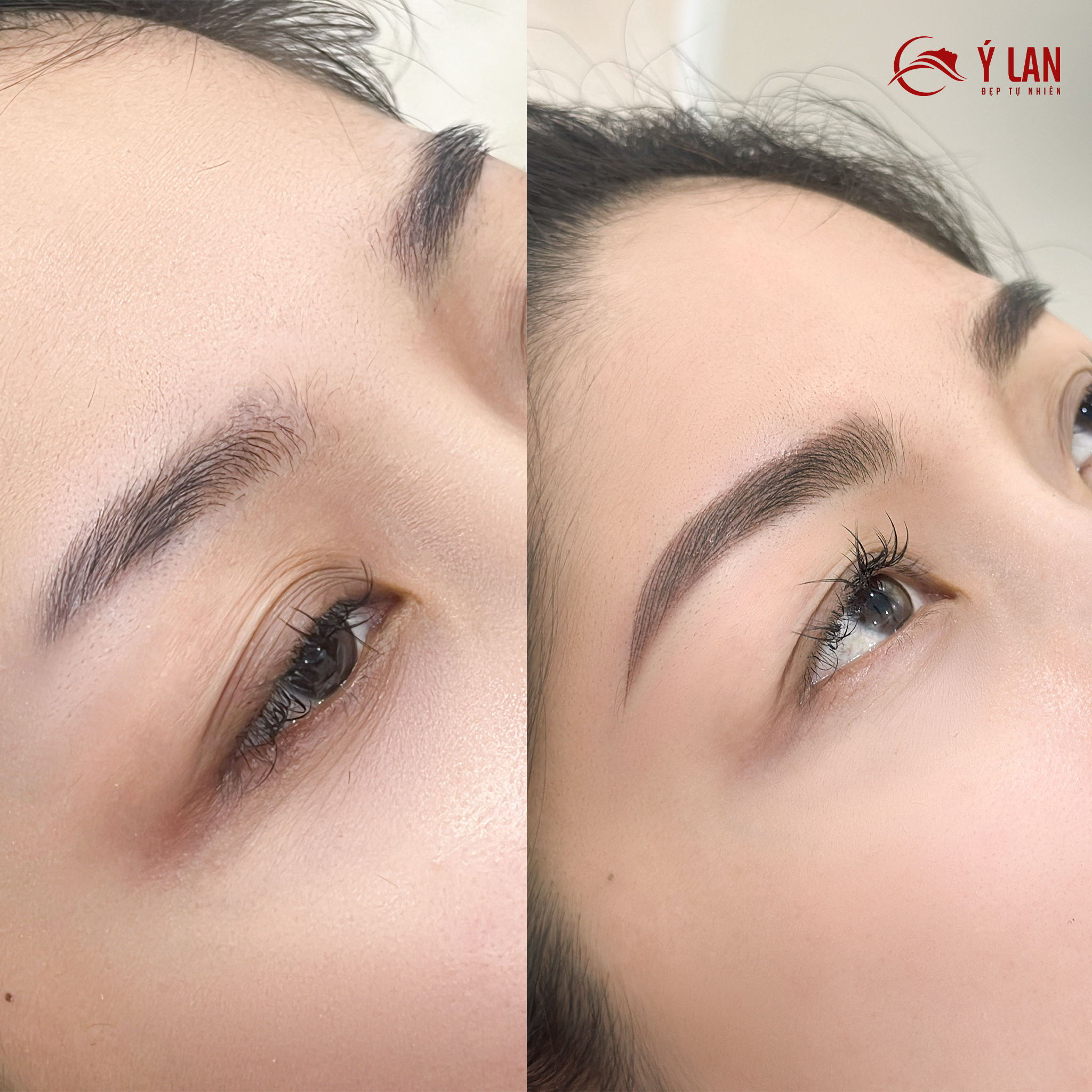 Thẩm Mỹ Viện Ý Lan
