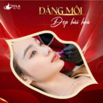 Phun Môi Collagen Tại Thẩm Mỹ Viện Ý Lan - Ảnh 4