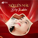 Phun Môi Collagen Tại Thẩm Mỹ Viện Ý Lan - Ảnh 3