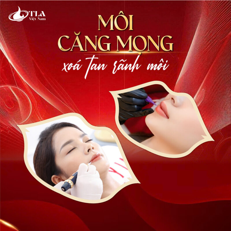Phun Môi Collagen Tại Thẩm Mỹ Viện Ý Lan - Ảnh 2