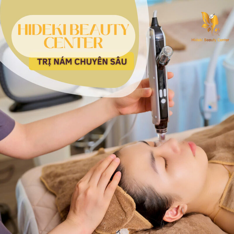 5 Buổi Trị Nám Chuyên Sâu - Cam Kết Hết Nám Tại Hideki Beauty Center