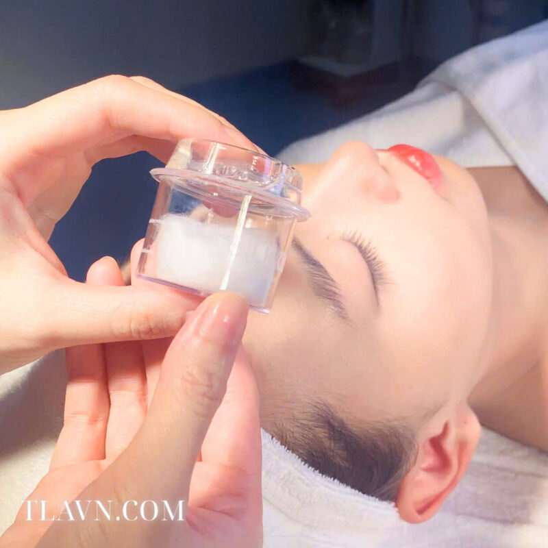 Trẻ Hoá Da - Trị Liệu Chỉ Tơ Tằm Sinh Học Tại Aquamedi Spa - Ảnh 2