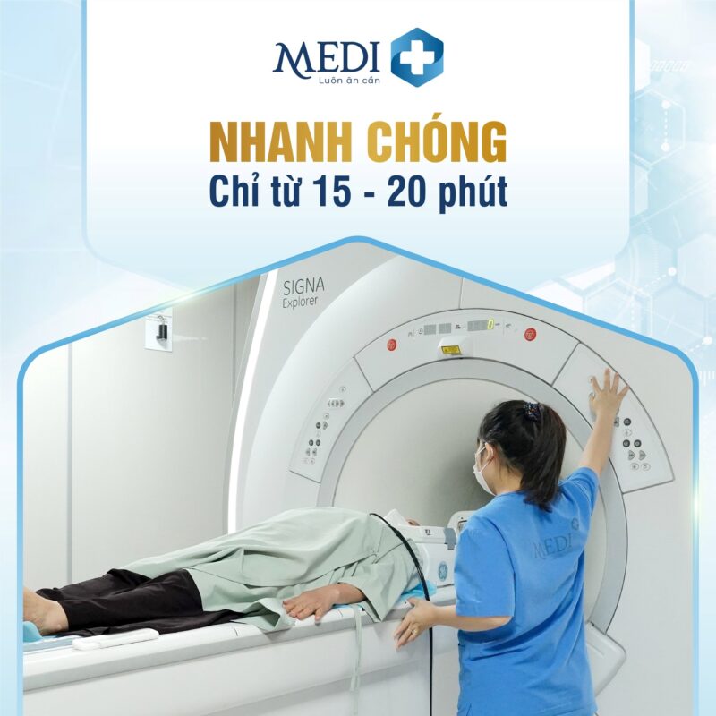 GÓI KHÁM SỨC KHỎE NÂNG CAO CHO NAM GIỚI TẠI MEDI PLUS - Ảnh 4