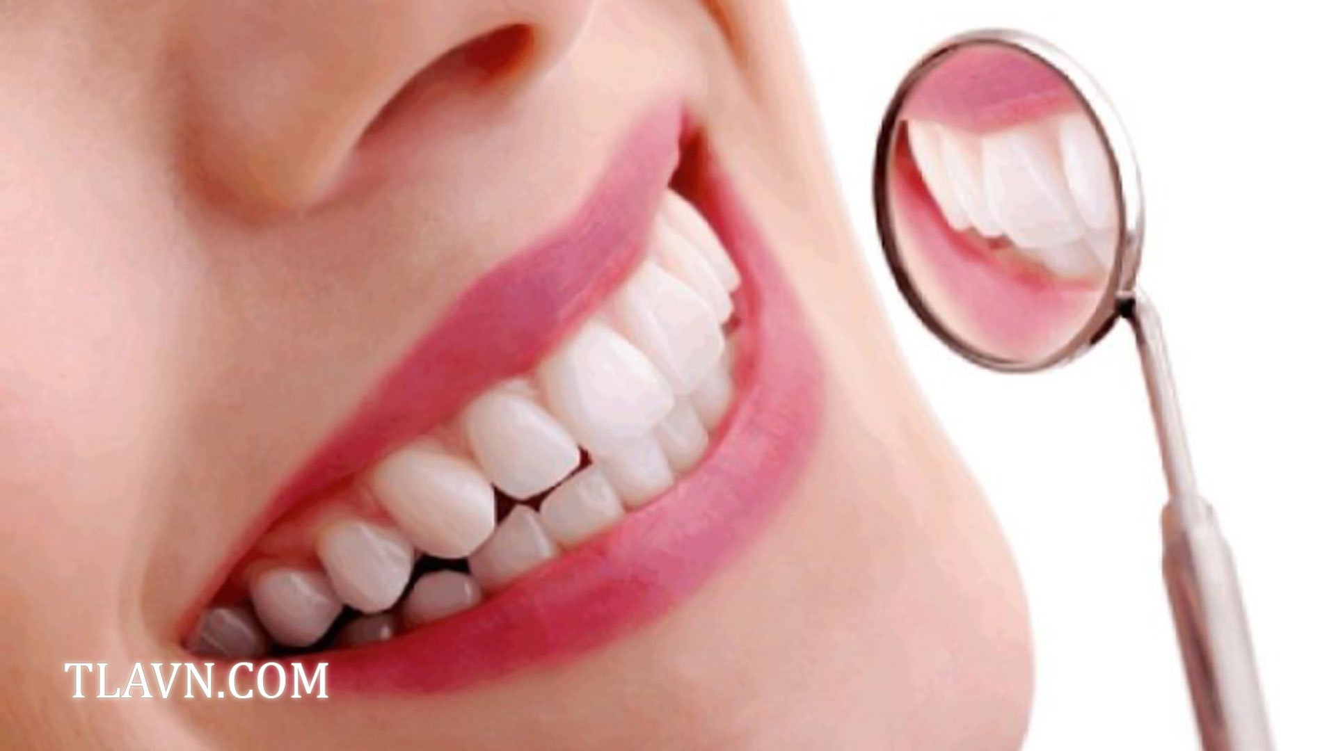 Tẩy trắng răng toàn hàm tại Nha Khoa Quốc Tế Đông Đô