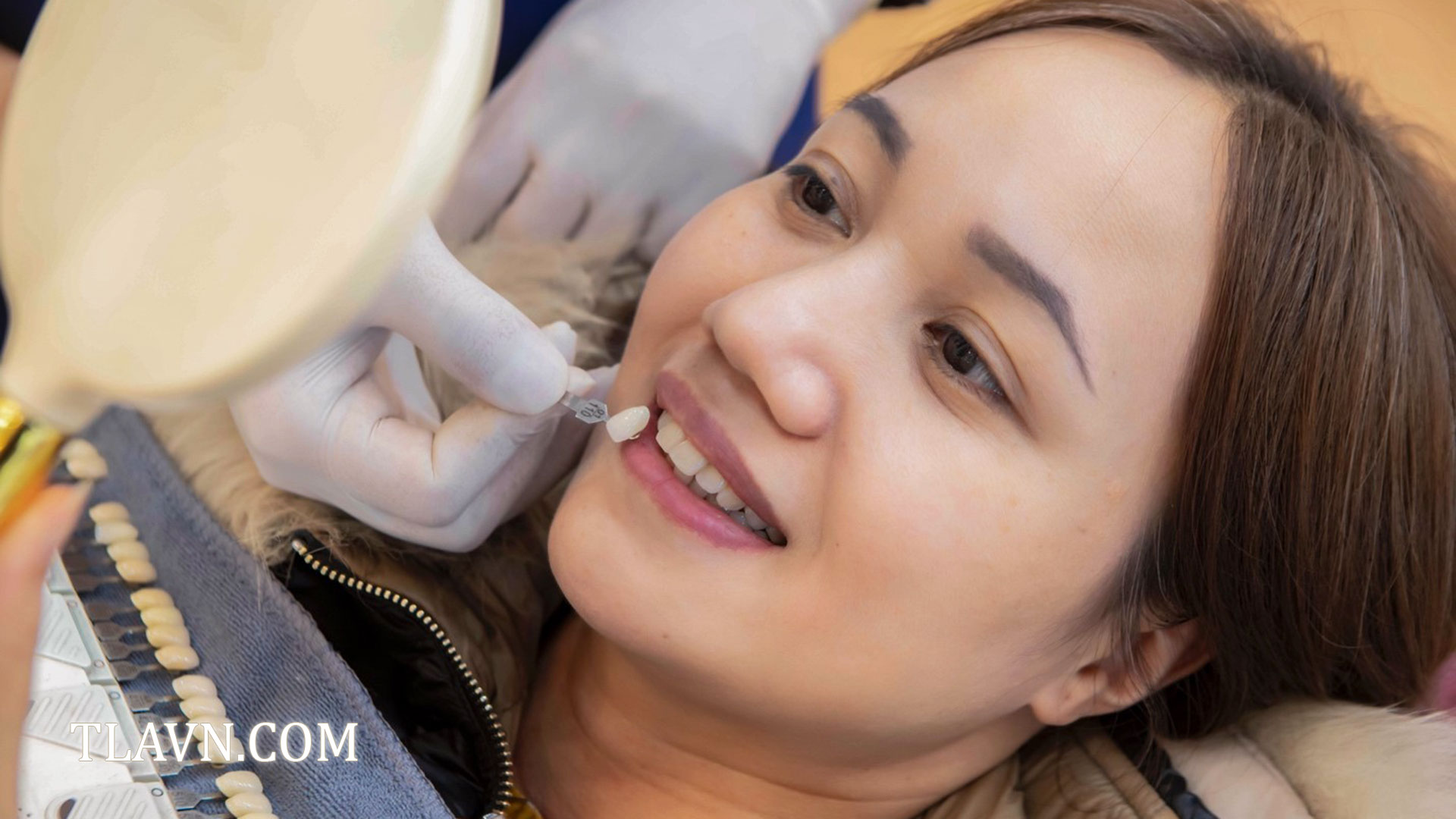 Tẩy trắng răng toàn hàm tại Nha Khoa Quốc Tế Đông Đô