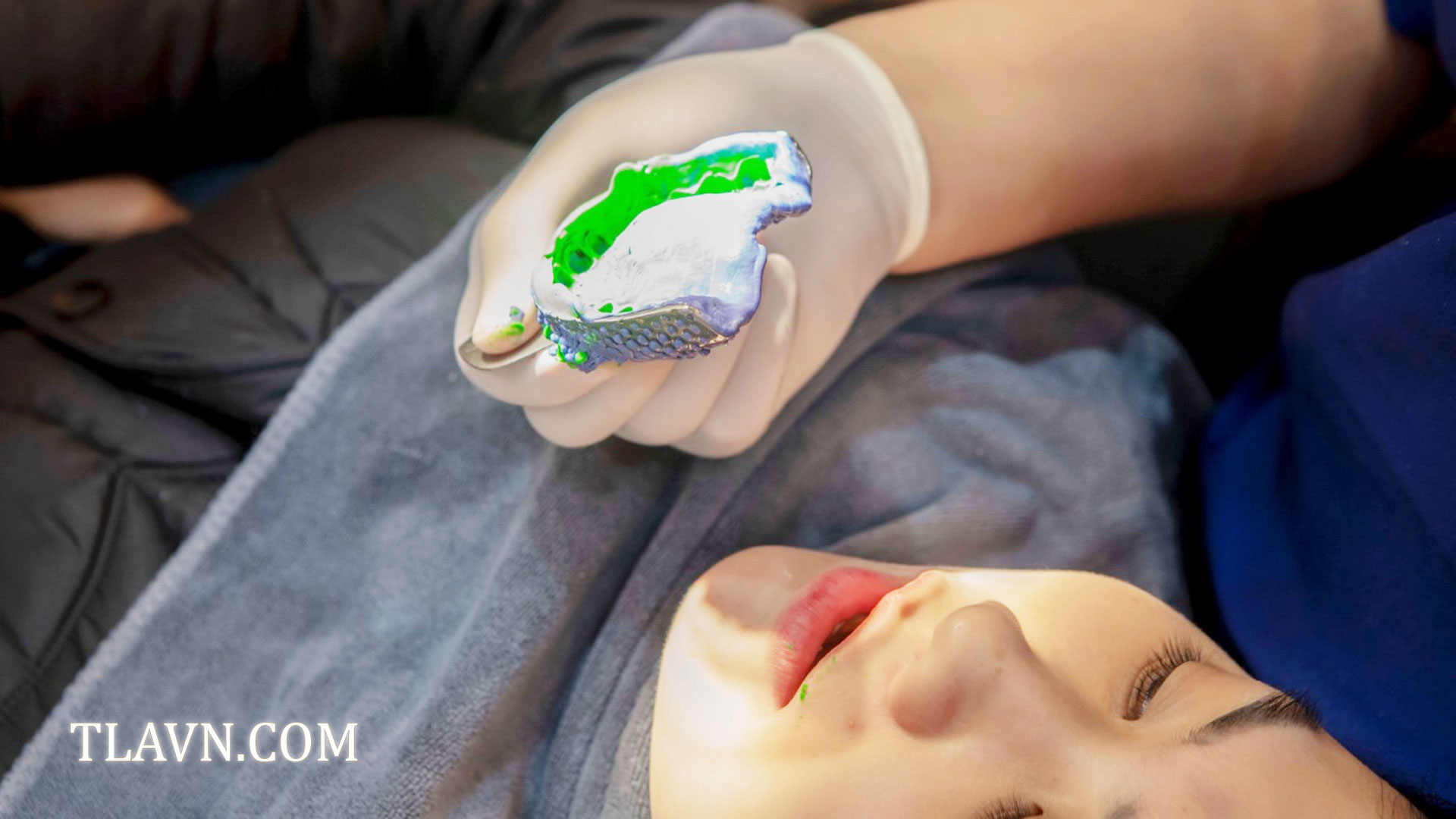 Cắm Trụ Implant Thẩm Mỹ tại Nha Khoa Quốc Tế Đông Đô