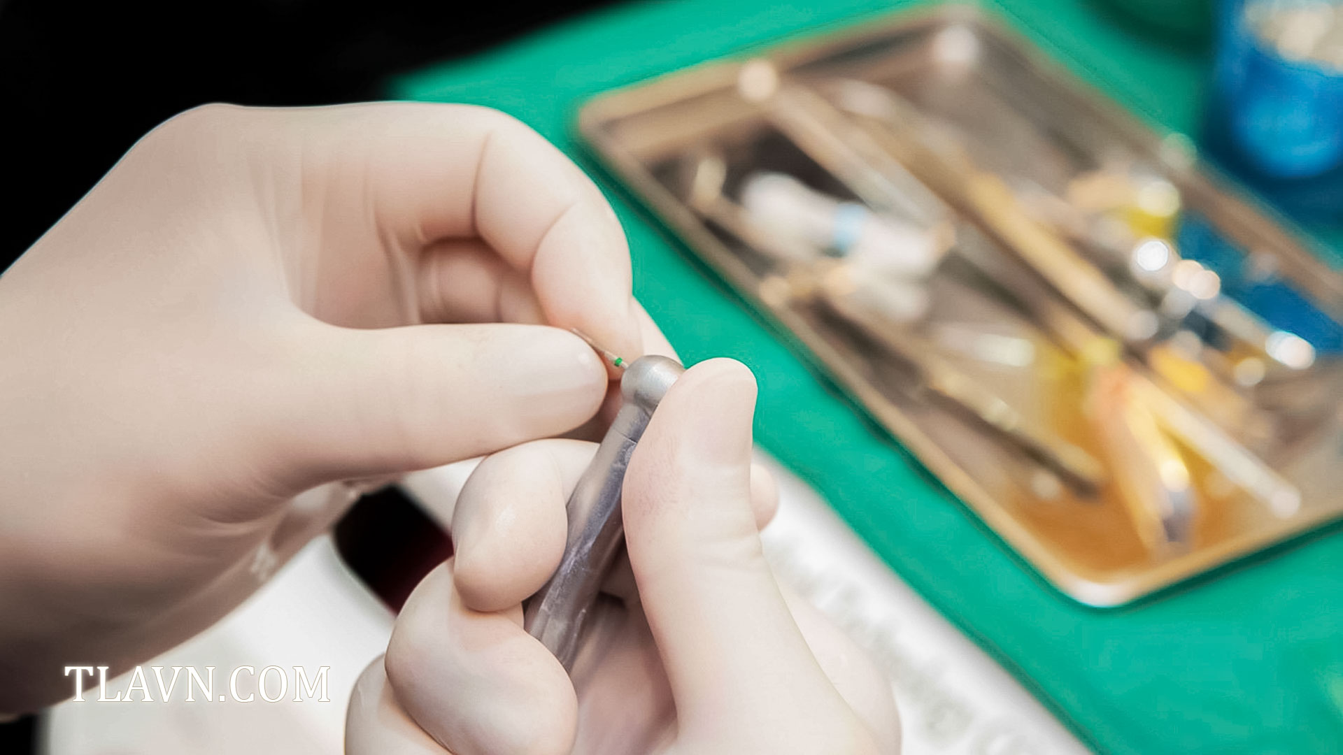 Tẩy trắng răng toàn hàm tại Nha Khoa Quốc Tế Đông Đô