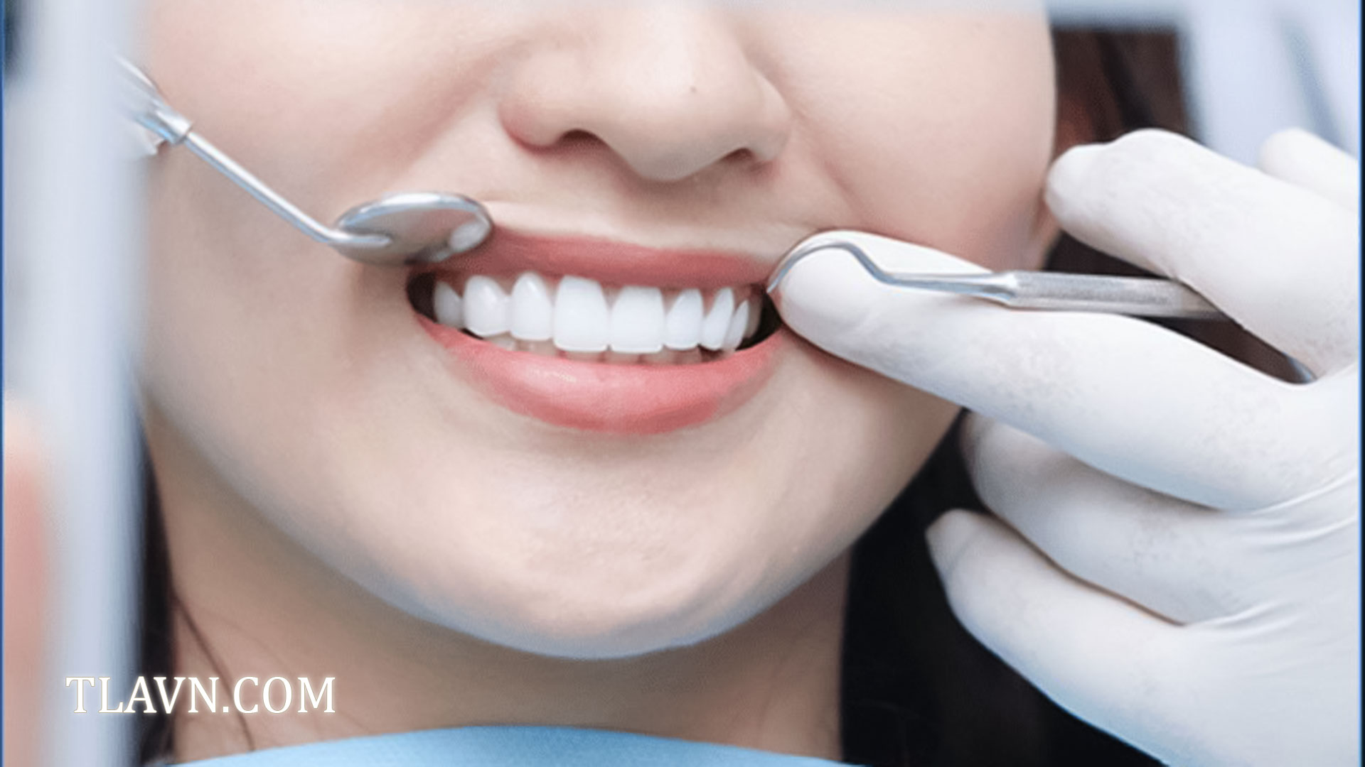 Tẩy trắng răng toàn hàm tại Nha Khoa Quốc Tế Đông Đô