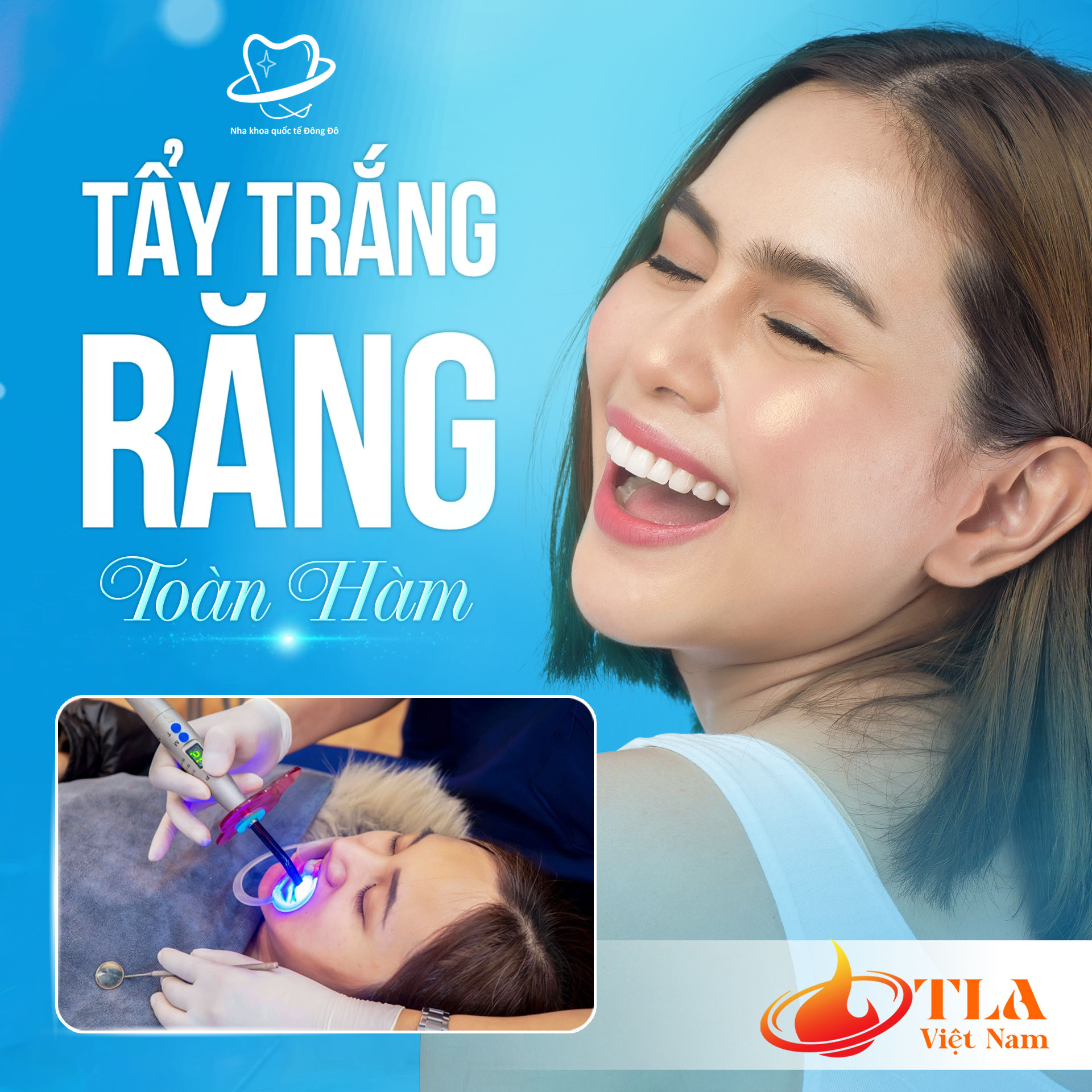Tẩy trắng răng toàn hàm tại Nha Khoa Quốc Tế Đông Đô