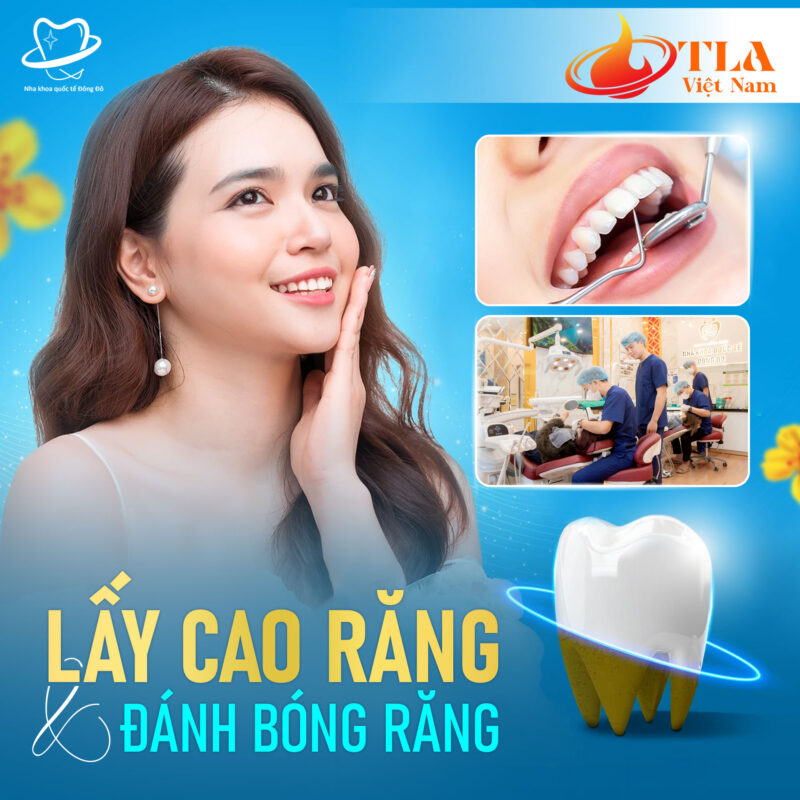 Lấy cao răng, đánh bóng răng tại nha khoa Quốc tế Đông Đô