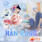 Hàn Răng Sâu Vỡ Hết Ê Buốt Tức Thì Tại Nha Khoa Quốc Tế Đông Đô